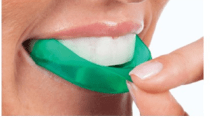 Opalescence Tooth Whitening