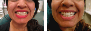 Restorative and General Dentistry