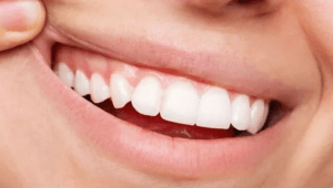 Signs of Gum Disease compared with these healthy gums...