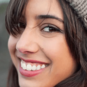 Gummy Smile