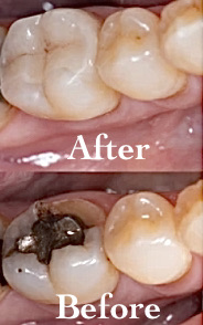 Mercury Free Dentistry, Morton Grove