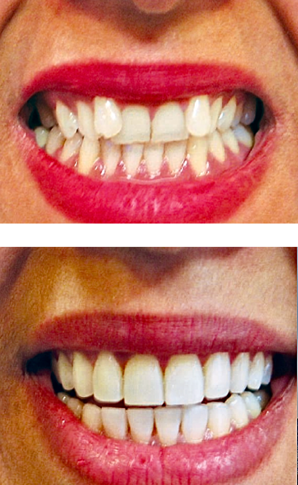 Areas We Serve Niles, ProCare Family Dental