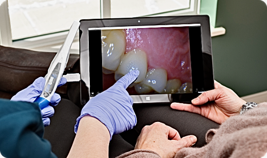Dentist using intraoral camera to show tooth condition on screen at ProCare Dental in Morton Grove