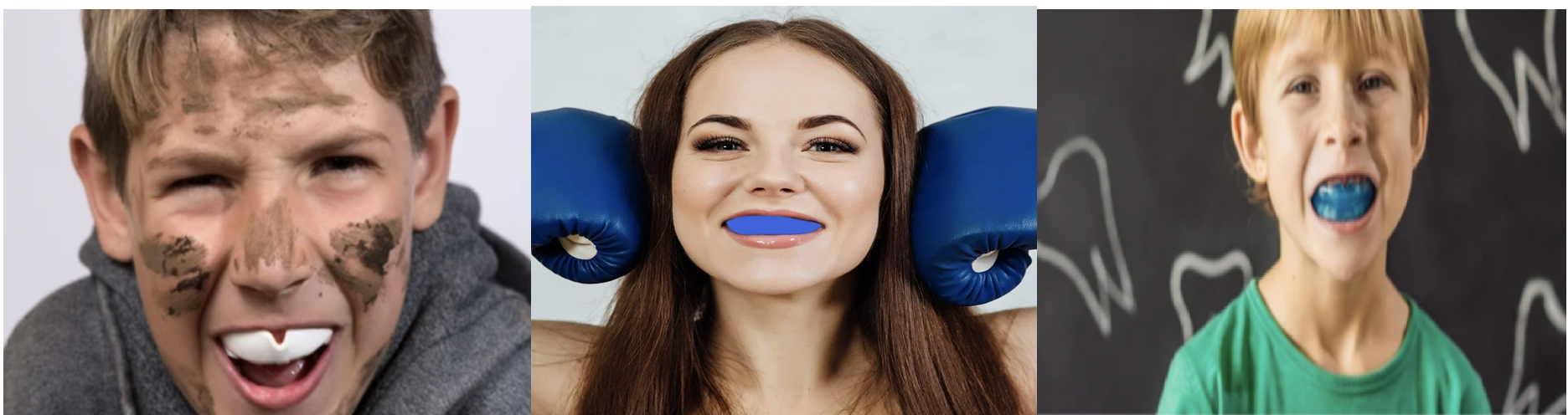 People  wearing  mouth  guards  