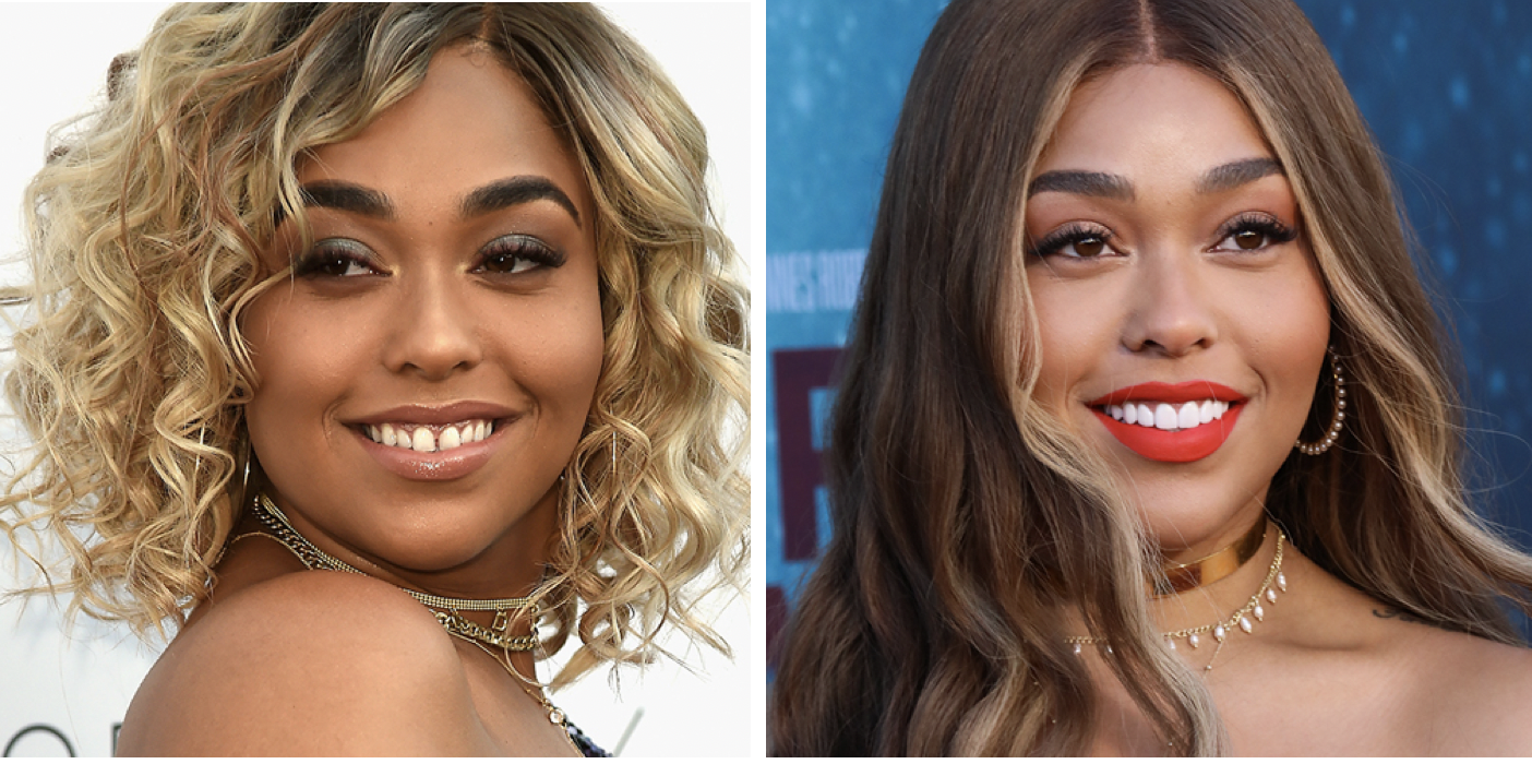 Jordyn Woods before and after veneers