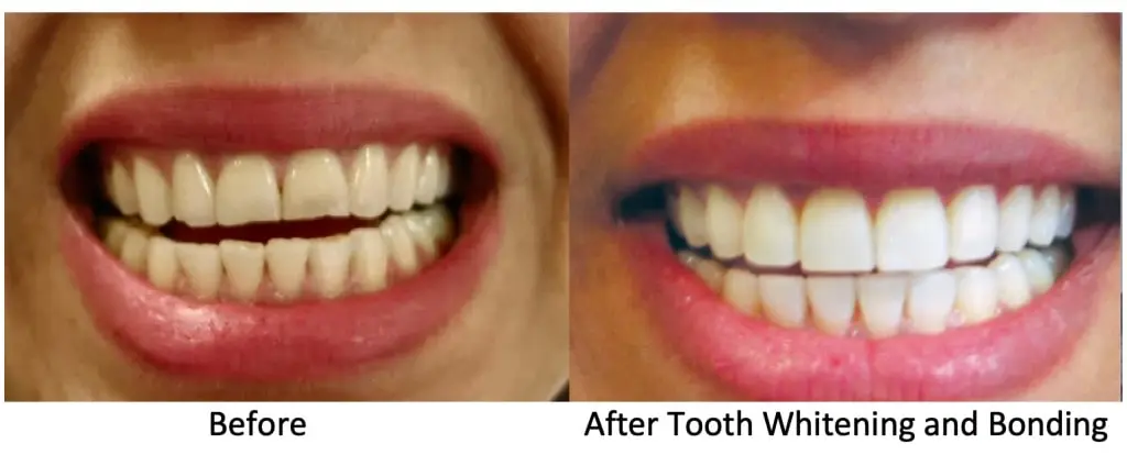 Cosmetic Dentistry Main Image Procare Dental