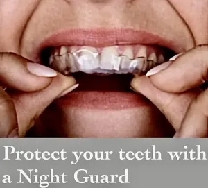 Niteguard in the patient's mouth