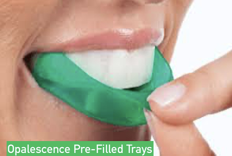 Opalescence Go prefilled whitening trays from ProCare Family Dental in Morton Grove