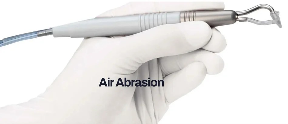 Air abrasion dental tool used for gentle cavity treatment in Morton Grove