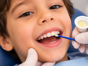 Close-up of fluoride varnish being applied to a child's teeth during a preventive dental visit at ProCare Family Dental in Morton Grove, Illinois.